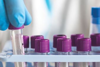 FDA Approves Lurbinectedin and Atezolizumab Combination for Extensive-Stage Small Cell Lung Cancer